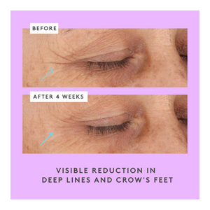 Ceramighty AF Eye Cream with Ceramides