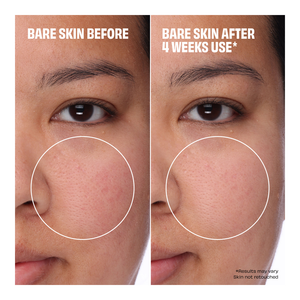 The Porefessional Foundation