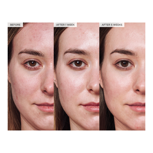 Avocado Ceramide Recovery Serum