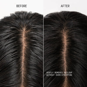 Clarifying Shampoo & Scalp Scrub