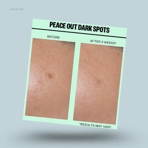PEACE OUT DARK SPOTS